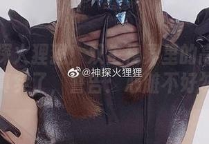 来看神探火狸狸！双生视界里的高清美图，太真实了，警告：心脏不好勿入。